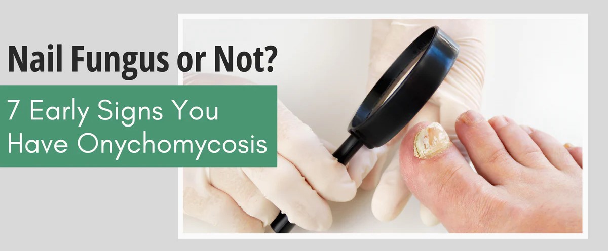Onychomycosis